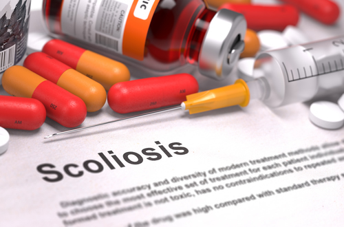 Scoliose? Lees hoe chiropractie je helpt